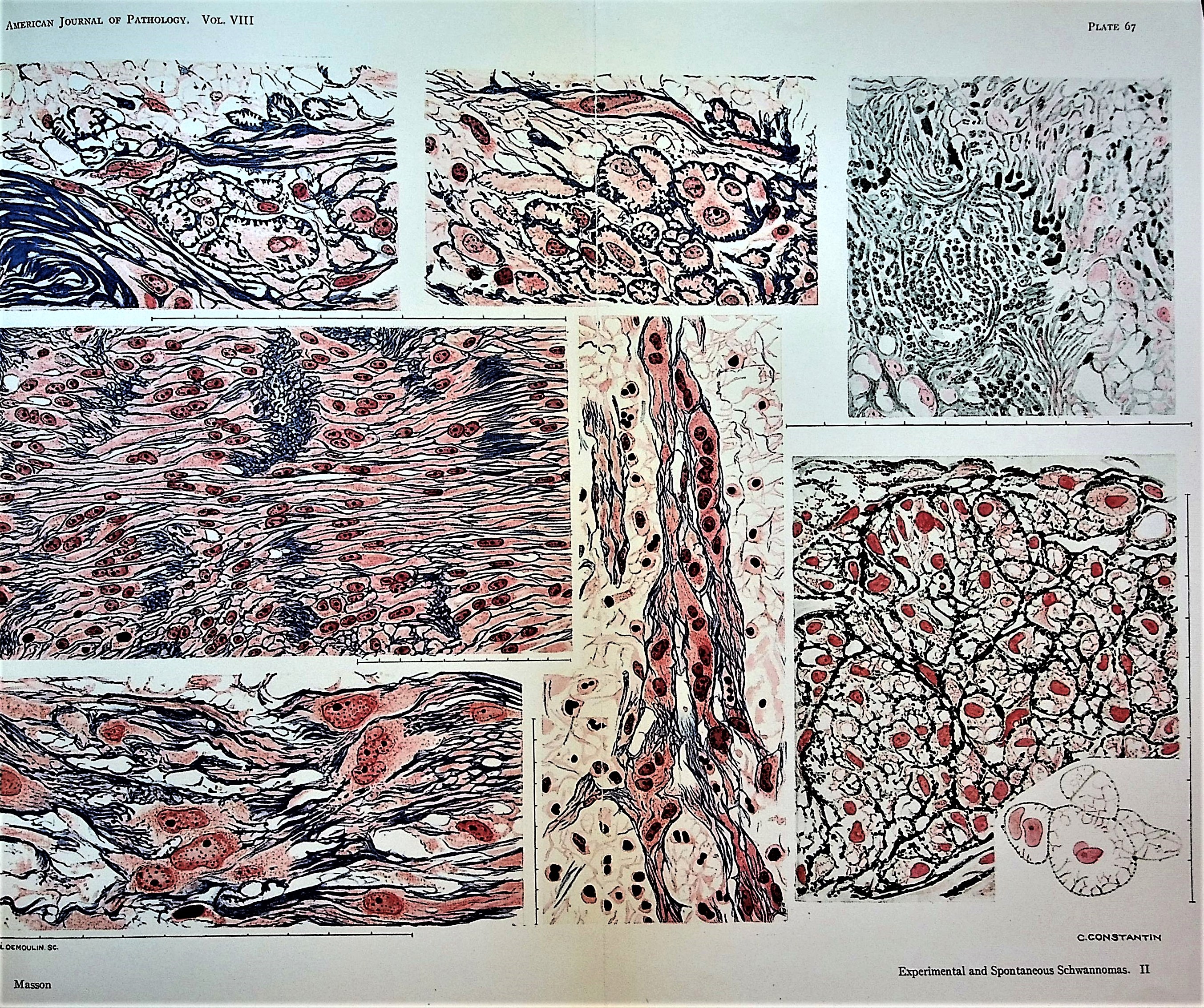 Image for Experimental and spontaneous schwannomas (peripheral gliomas). I. Experimental schwannomas; II. Spontaneous schwannomas