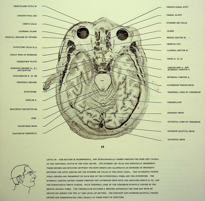 Anatomy of the Head & Neck (crosssectional views)