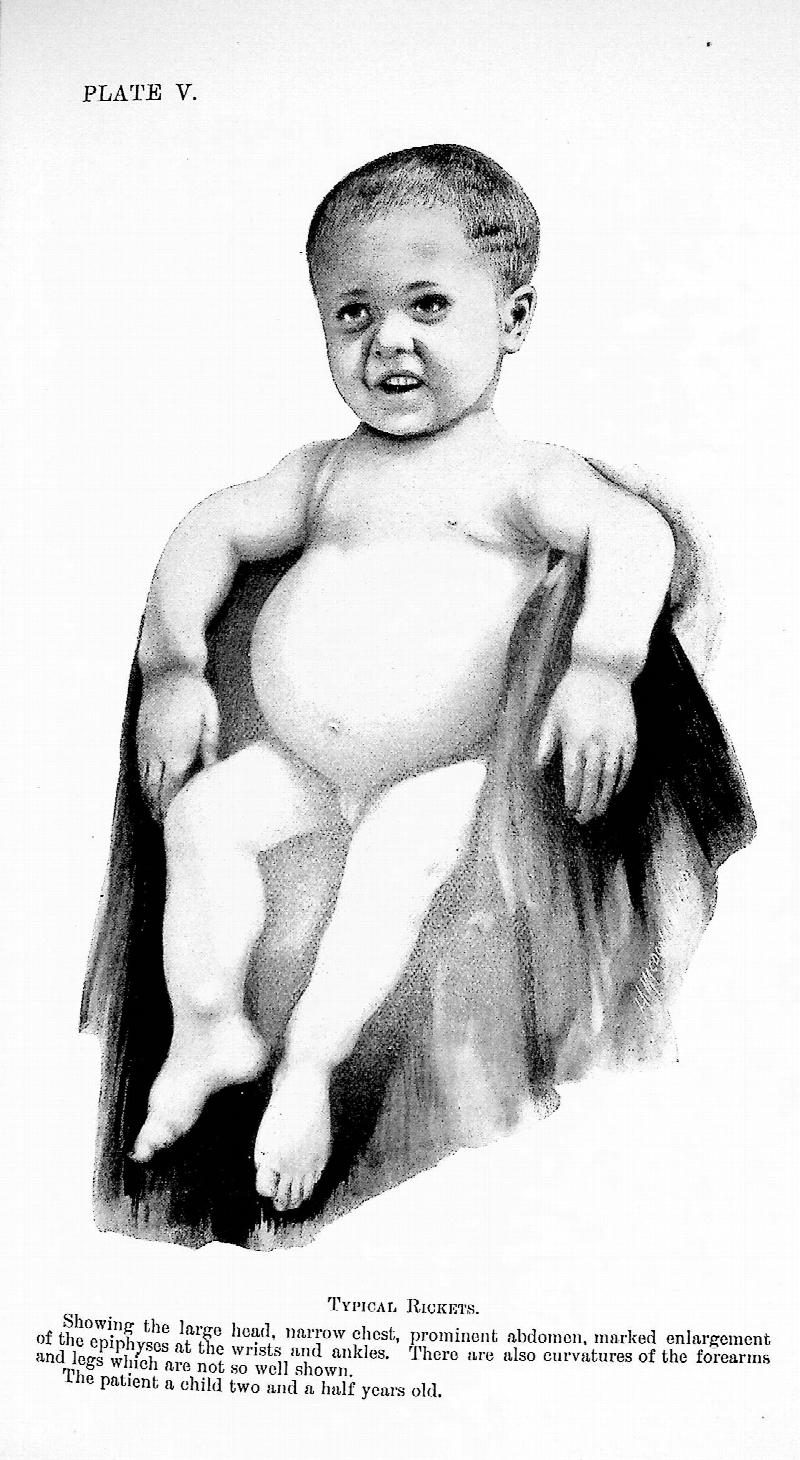 Image for The Diseases of Infancy and Childhood for the Use of Students and Practitioners of Medicine