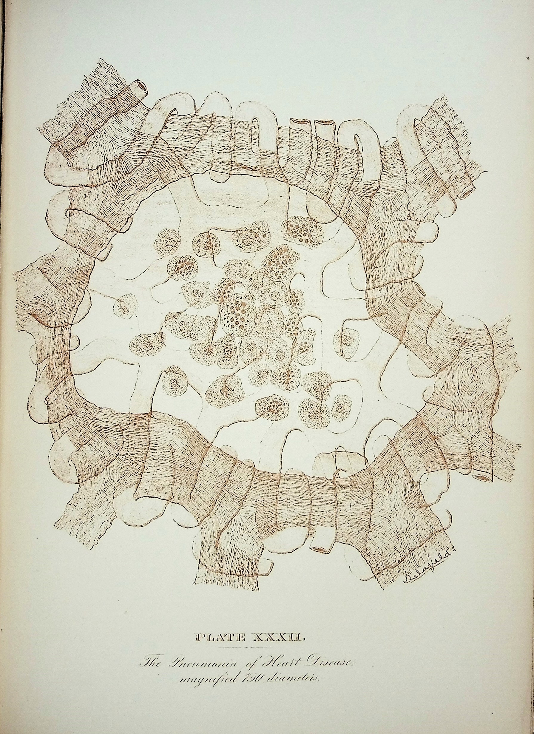 Studies in Pathological Anatomy