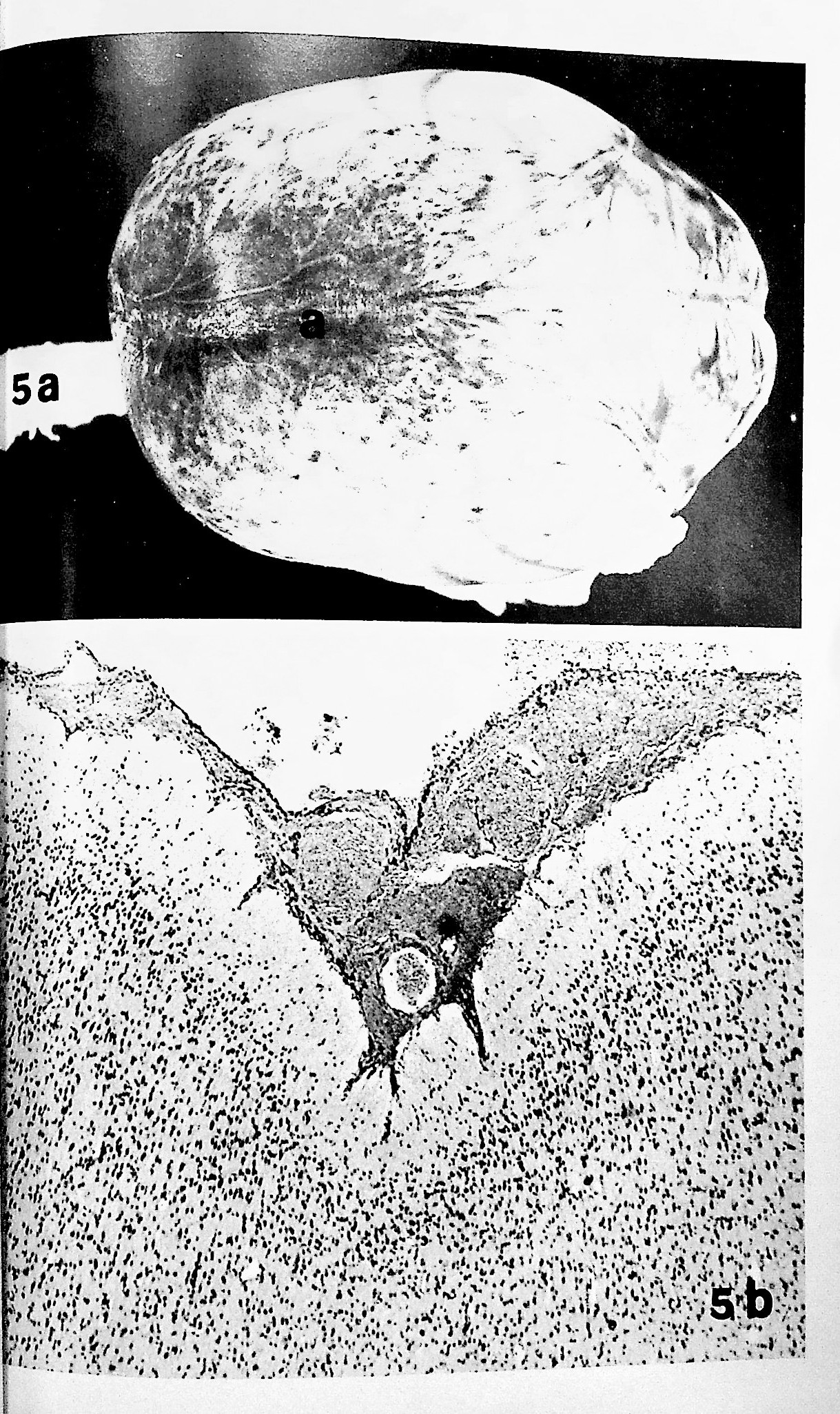 1, Traumatic lesions of brain and spinal cord due to nondeforming angular acceleration of the head [Tex Rep Biol Med. 1969 Spring;27(1):127-66] TOGETHER WITH 2. About boxing: review of historical and medical aspects [Tex Rep Biol Med. 1970 Winter;28(4):421-95]
