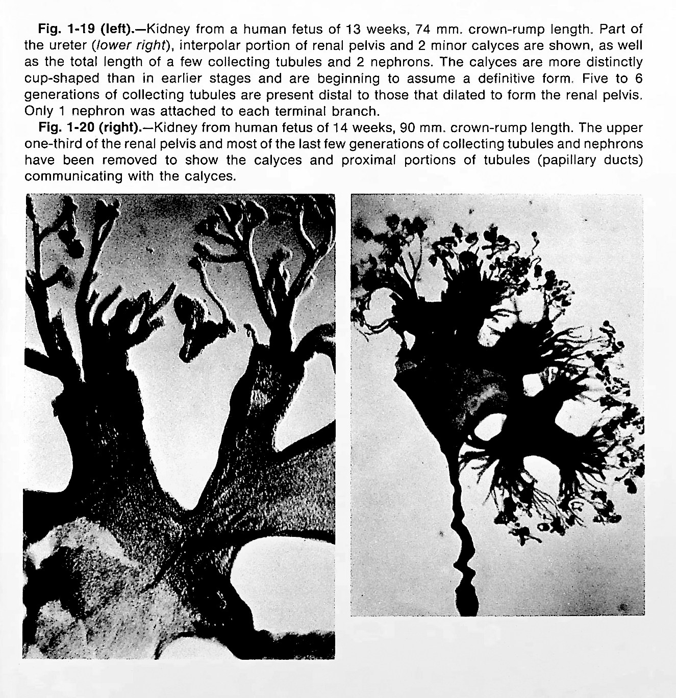 Normal and Abnormal Development of the Kidney