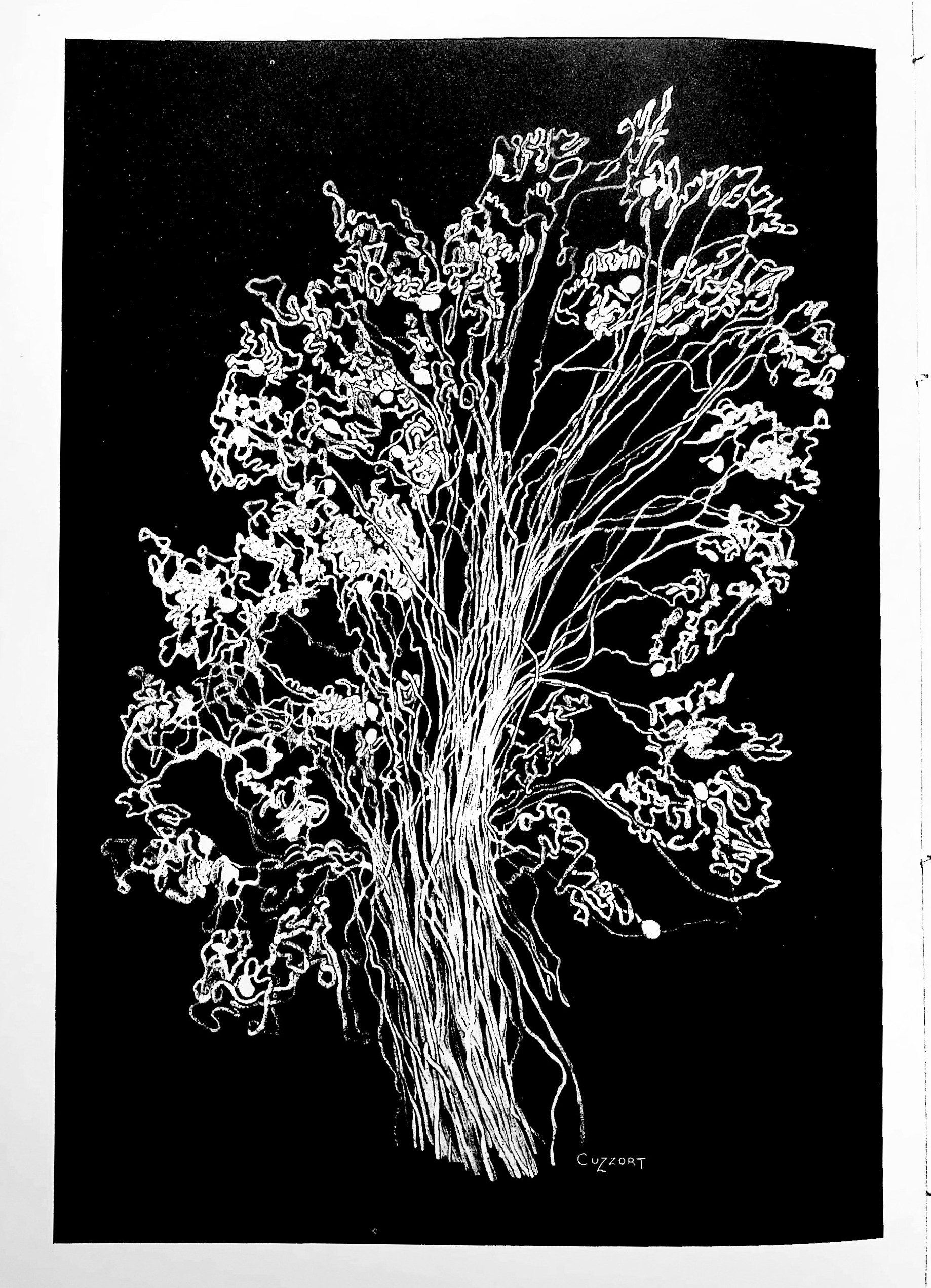 Architecture of the Kidney in Chronic Bright's Disease