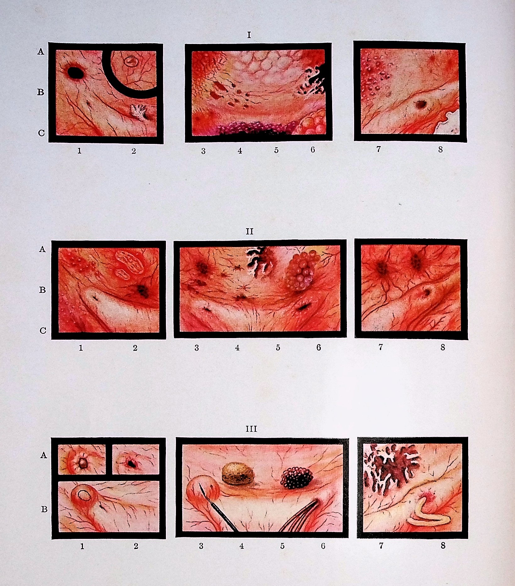 Pediatric Urology with a section on Bright's Disease in Infancy and Childhood by John D. Lyttle, with over 1350 illustrations on 610 figures and two colored plates