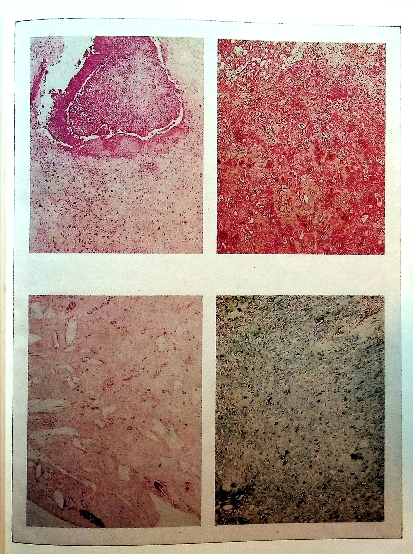 Diseases of the Kidney