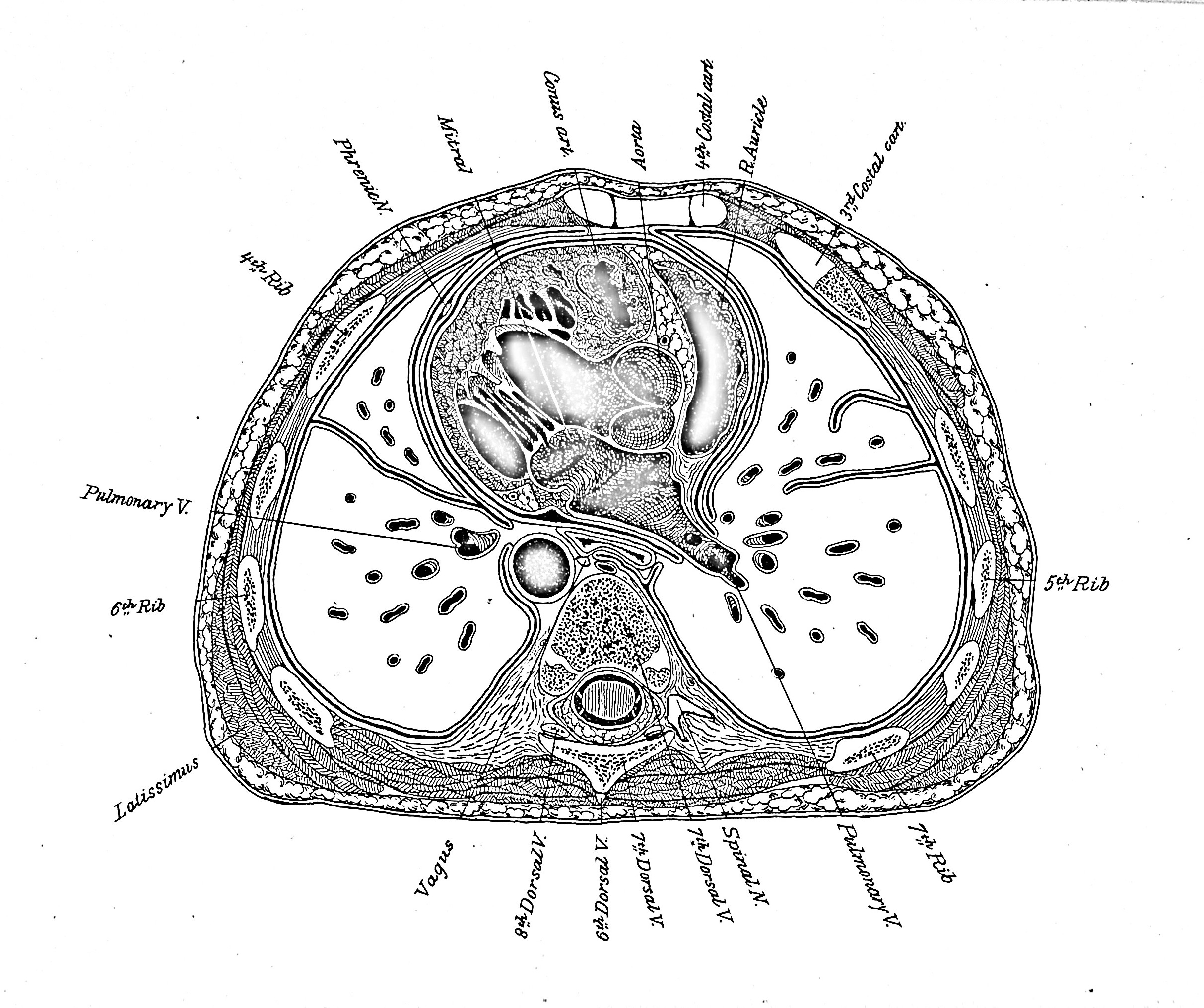 Frozen Sections of a Child. Fifteen Drewings from Nature