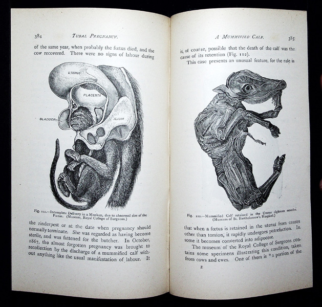 Image for Surgical Diseases of the Ovaries and Fallopian Tubes, including Tubal Pregnancy