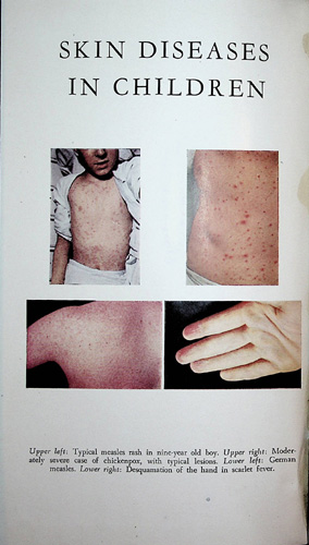 Image for Skin Diseases in Children