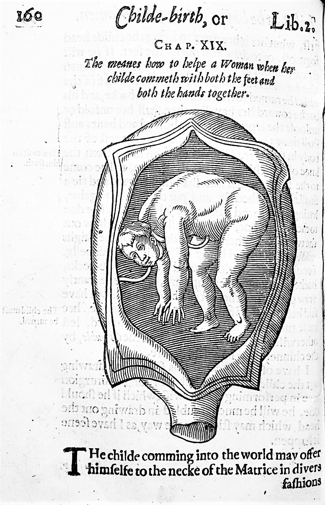 Image for Child-Birth, or, the Happy Delivery of Women. Wherin is set downe the Government of Women in the time Of their breeding Childe: Of their Travaile, both Naturall and contrary to Nature: And Of their Lying in. Together with the diseases, which happen to Women in those times, and the meanes to helpe them. With a Treatise for the Nursing of Children. To which is added, a Treatise of the diseases of Infants, and young Children; with the Cur of them and also of the Small Pox. Written in French by James Guillimeau, the French King's Chirurgion.