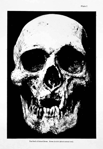 Image for King Robert the Bruce, 1274 - 1329. His Skull and Portraiture (published in Biometrika: a journal for the statistical study of biological problems)