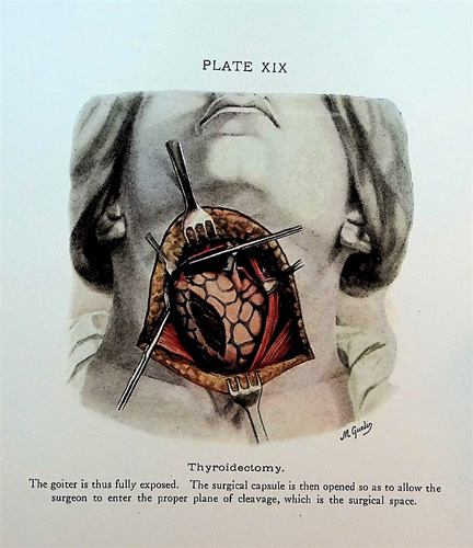 Image for Thyroid and Thymus, with 96 illustrations and 33 plates in color