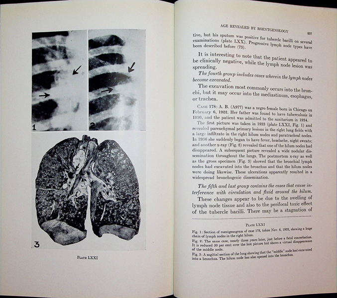 Image for Age Morphology of Primary Tubercles